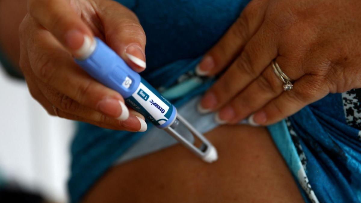 Ozempic mouth, weight loss drug, side effects, cosmetic treatments, dermal fillers, Ozempic