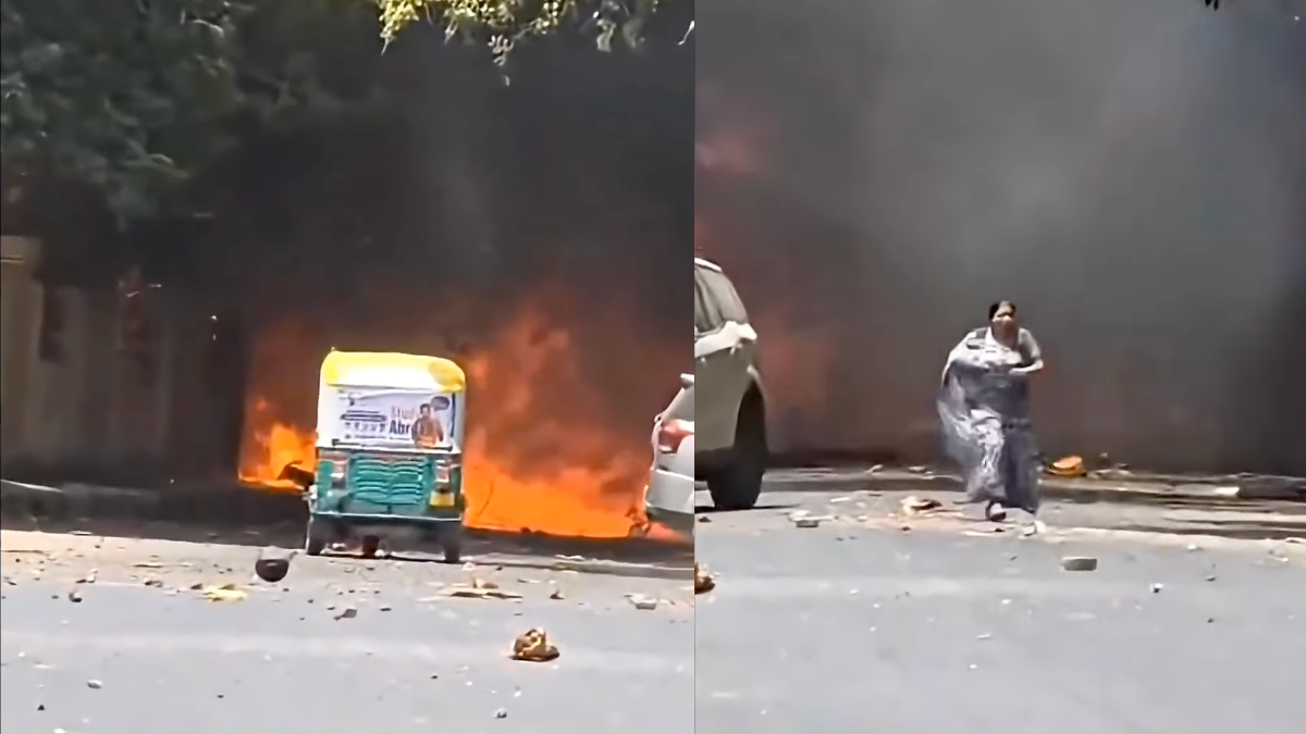 Ahmedabad plane crash: A mother, who was desperately trying to rescue her son who was caught in blaze after Air India flight crashed, has sustained severe burns.