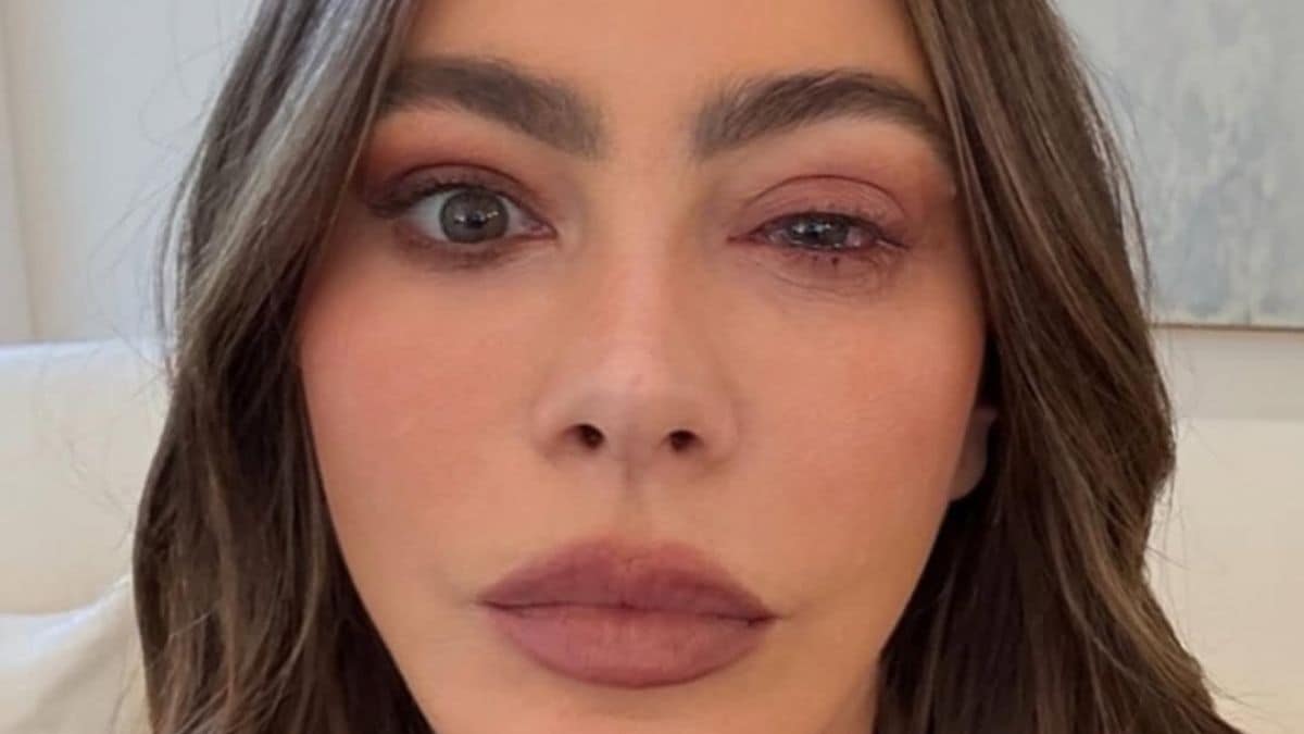 Sofia Vergara eye allergy